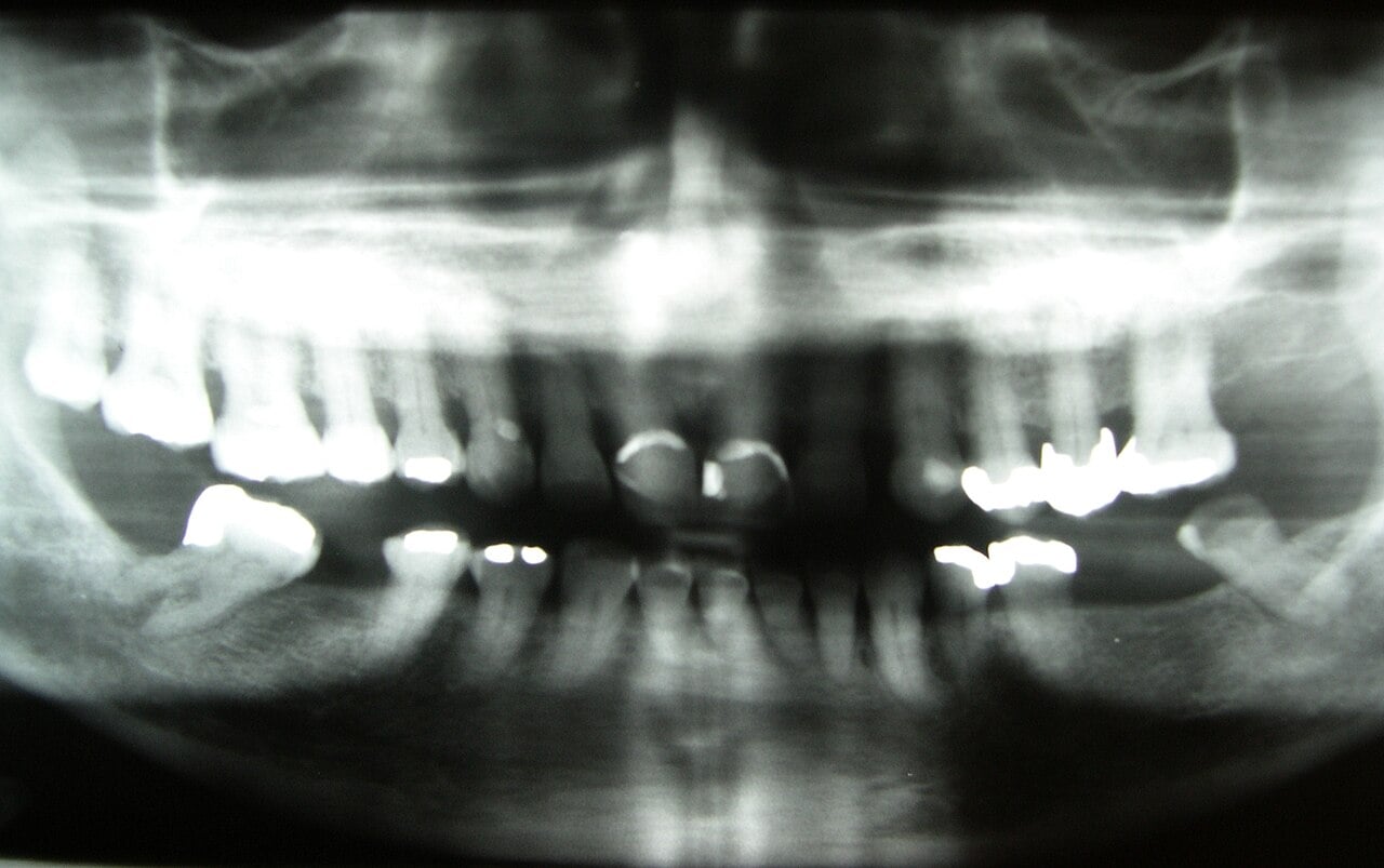 Radiograph Preview